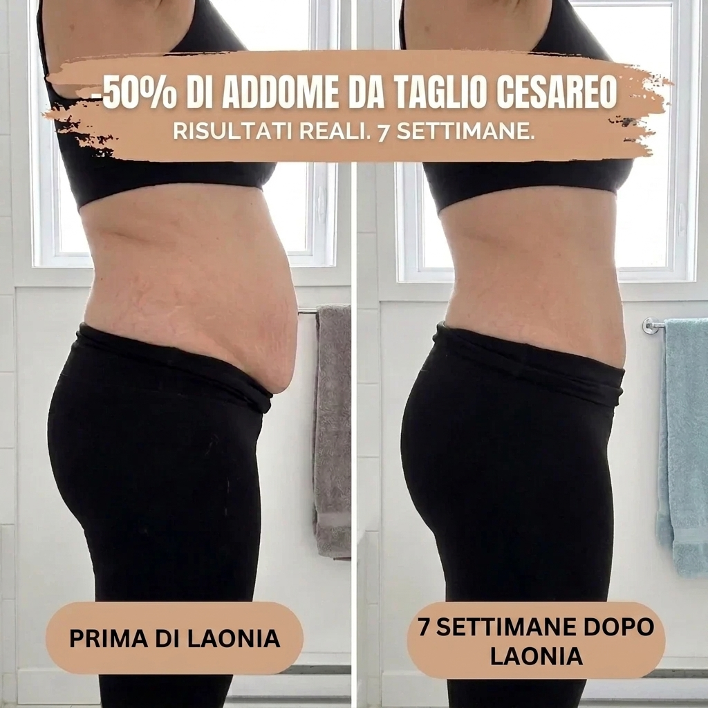 Culotte Modellante Laonia a Compressione 360°
